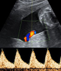 Dr. Horst Meyberg - Facharzt für Pränataldiagnostik & Frauenheilkunde in Ludwigsburg
